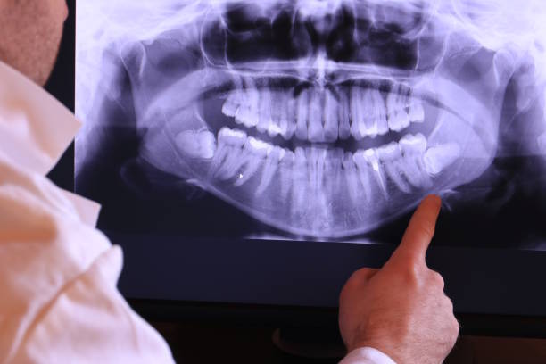Best Cosmetic Emergency Dentistry in Pce, LA
