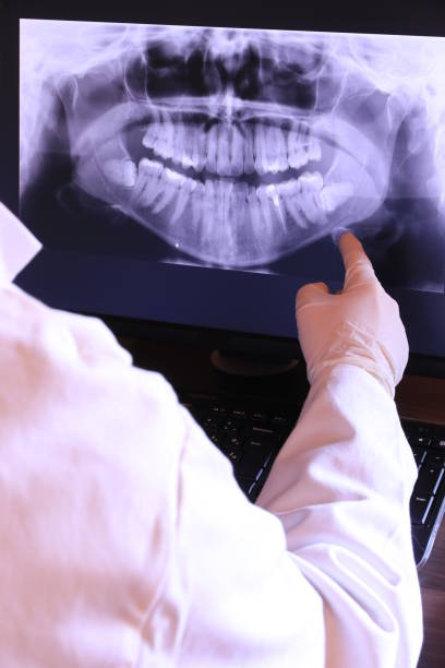 Best Pediatric Emergency Dentist in Pce, LA